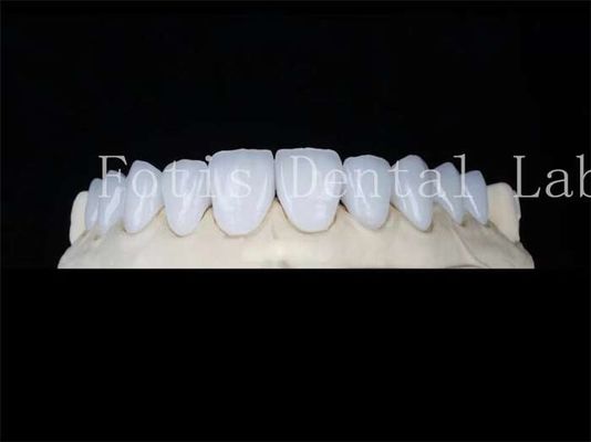 شراء ملفات البورسلين الطبيعي المخصصة ملفات المختبر الأسنان المقاومة للبقع online manufacture