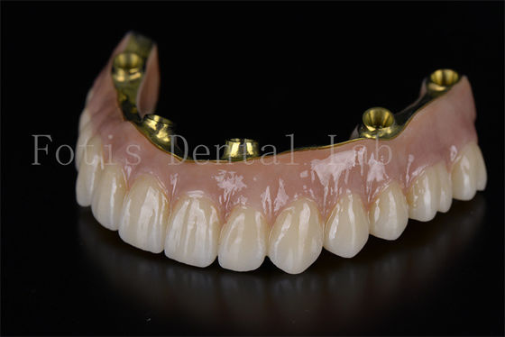 شراء استعادة القوس الكامل كل شيء على ستة زراعة الحل الحد الأدنى من الغزو online manufacture