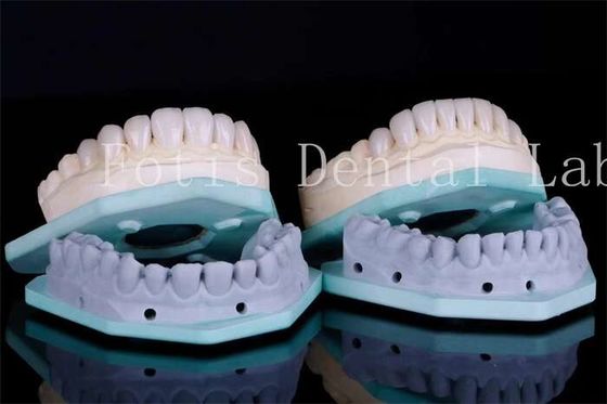 أظافر الأسنان المقاومة للبقع أظافر عيادة الأسنان 0.3mm-0.5mm سمك
