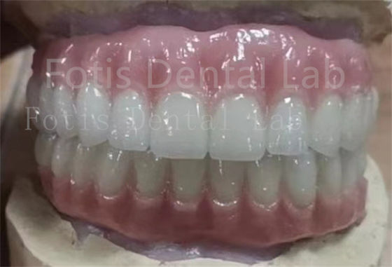 مناسبة بدقة أسنان أوكلار أكريليك متكاملة ضد البقع