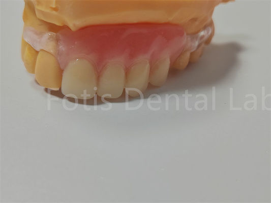 شهادة FDA / ISO TCS Valplast أسنان مرنة سهلة التنظيف