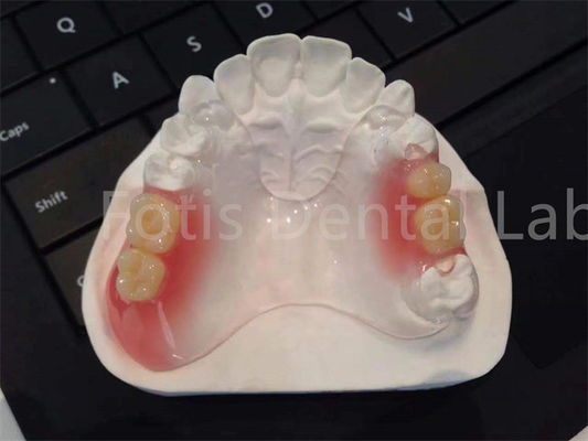 TCS مرنة أجهزة الأسنان Valplast مريحة تصميم دائم