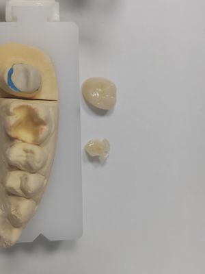 إعادة التجميل الطويلة الأمد طبقة الأسنان المتضخمة طبقة الأسنان المتضخمة القوة والمتانة