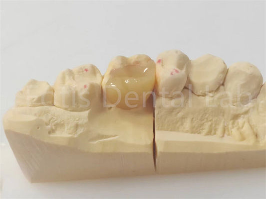 طب الأسنان الدقيق للترميم الدقيق والدائم